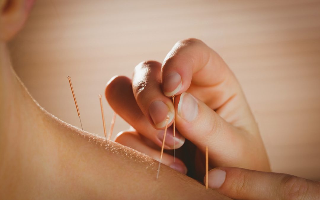 Free 15 – 20 minute consult for Acupuncture and Chinese Medicine with Francis :  